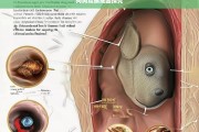 狗狗耳螨成因探究，狗狗耳螨成因分析