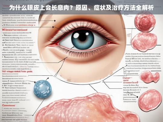 为什么眼皮上会长息肉？原因、症状及治疗方法全解析